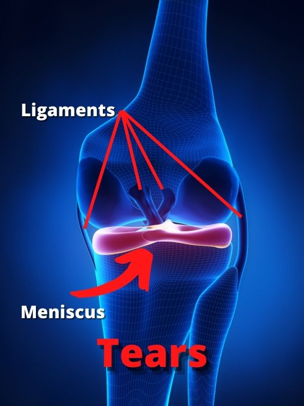 Ligaments and meniscus tears