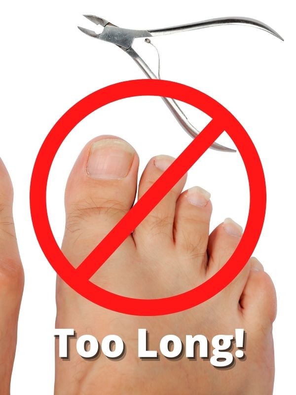 toenails too long