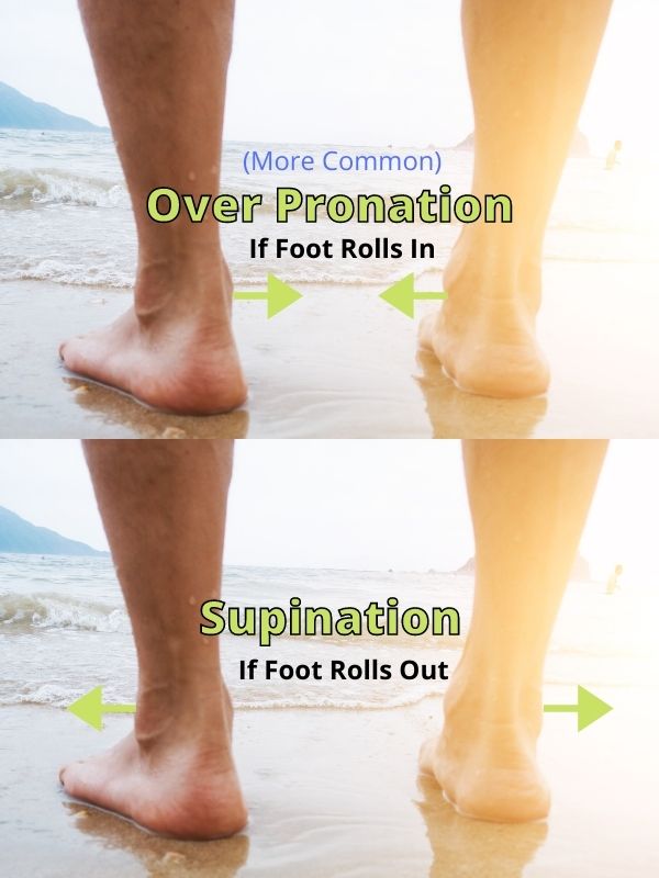 Over Pronation and supination