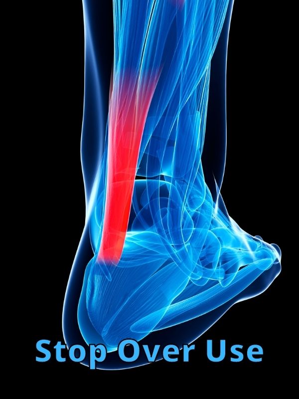 Stop Over Use Achilles Tendonitis